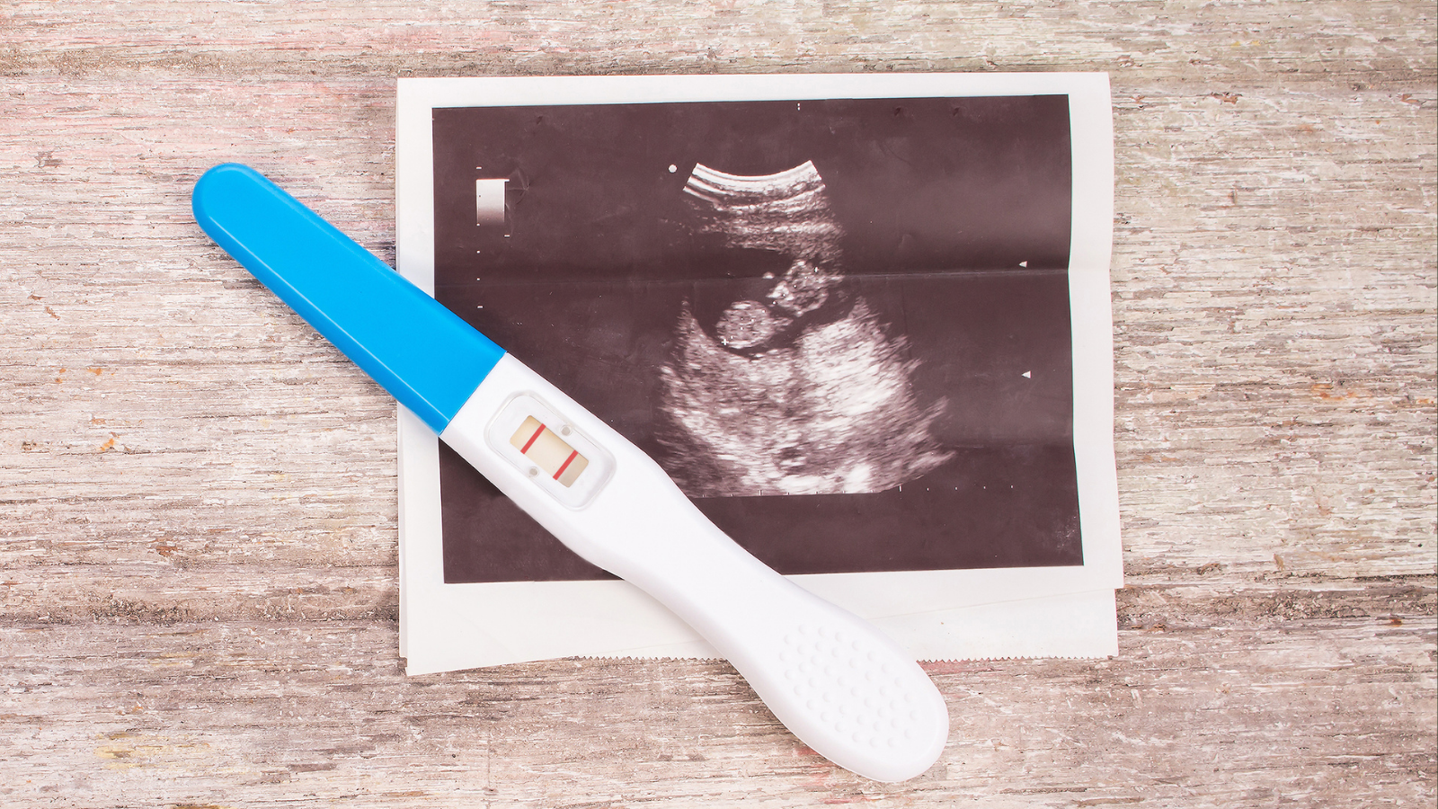 ultrasound image and pregnancy test